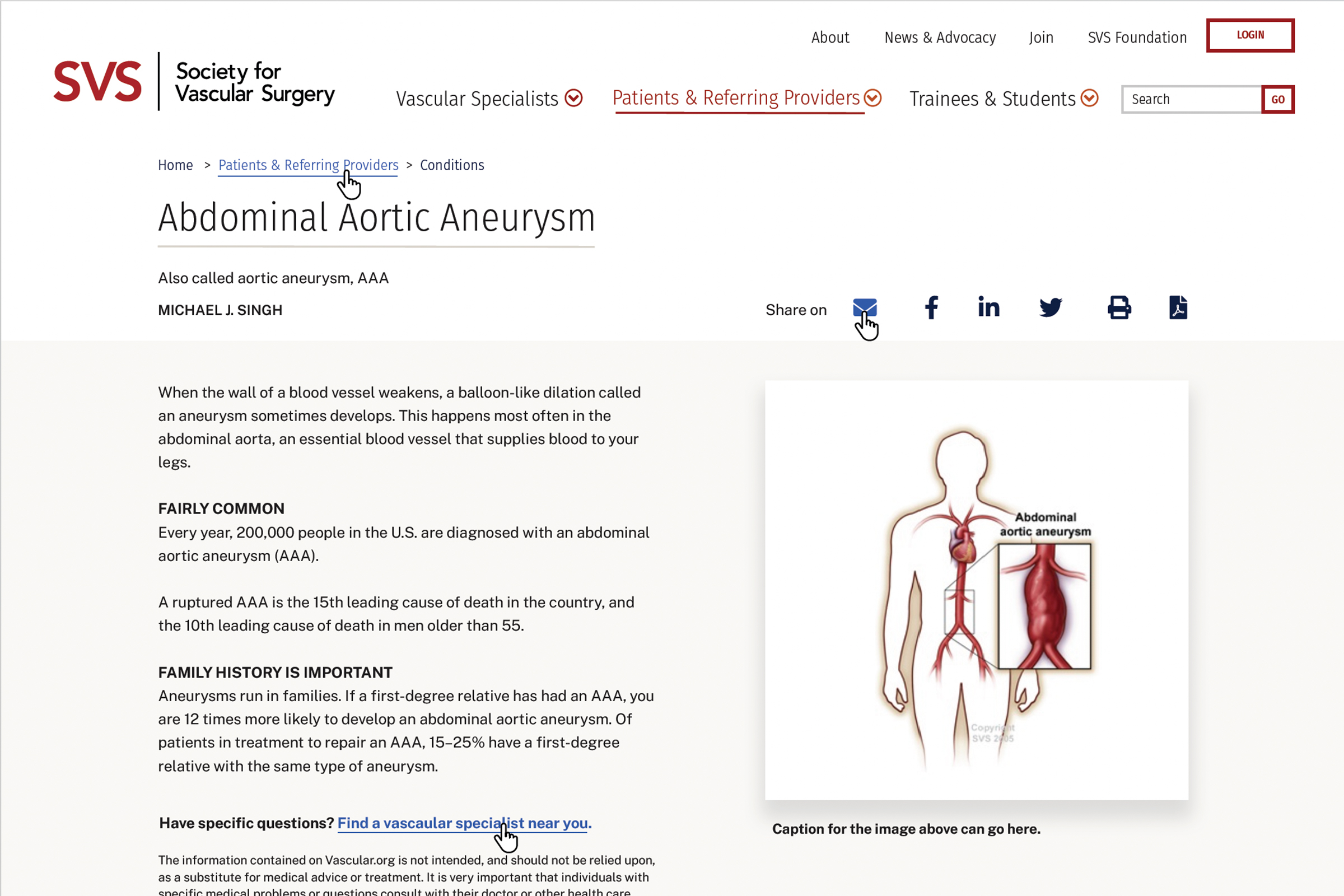 A patient condition page showing Abdominal Aortic Aneurysm with anatomical images and jump links to easily navigate content